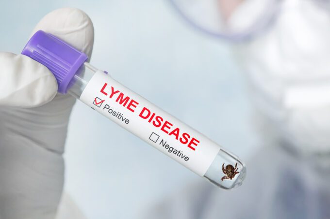 enfermedad de lyme